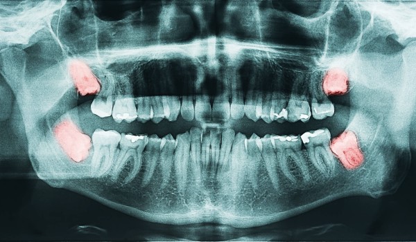 Clinica-Altea-studio-Dentistico-Viadana