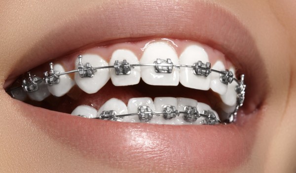 ortodonzia-studio-dentisti-viadana