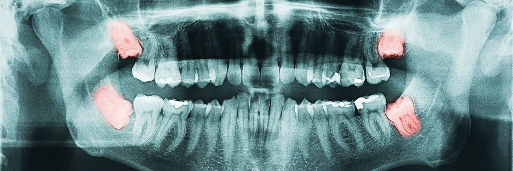 Clinica-Altea-studio-Dentistico-Viadana
