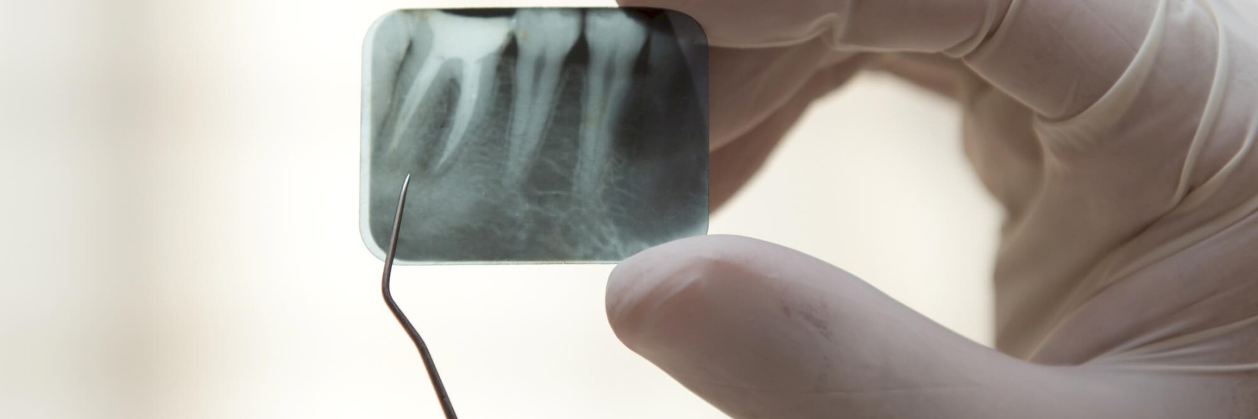 endodonzia-endodontista-viadana-studio-dentisti