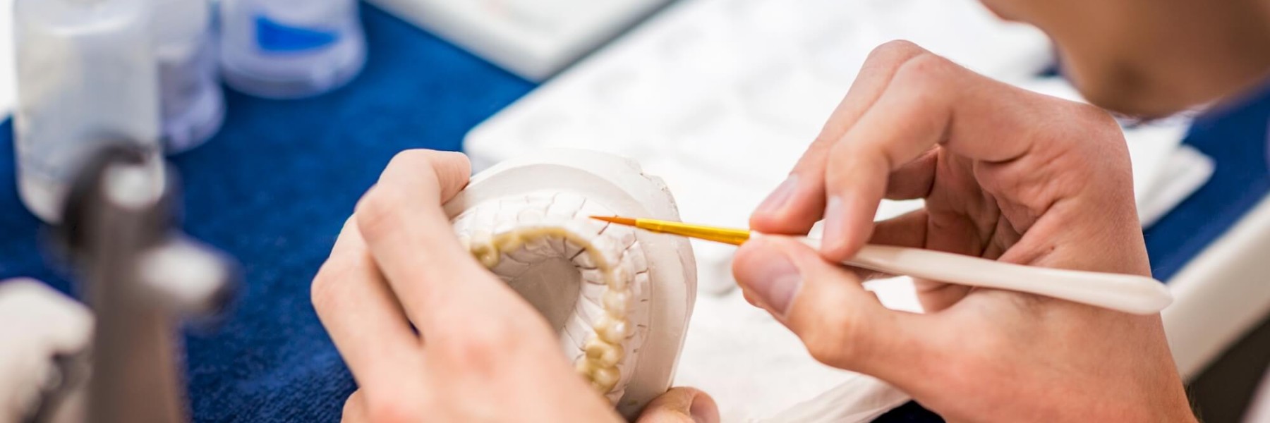 protesi-dentale-viadana-dentista